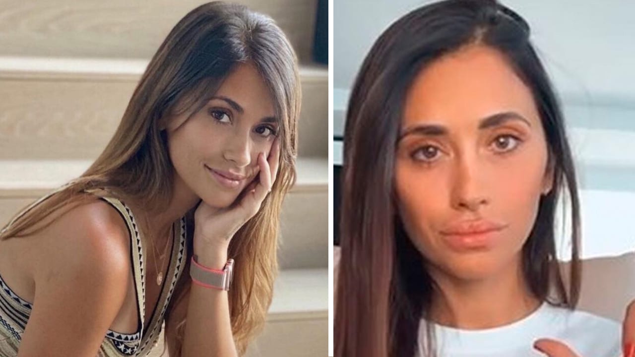 ¿Qué se hizo en la cara? El video de Antonela Roccuzzo que impactó a todos en las redes sociales