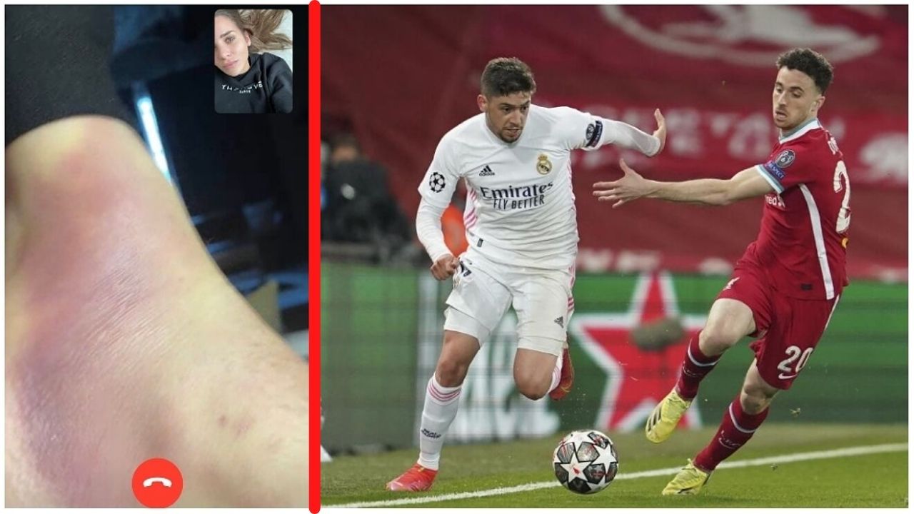 La impactante imagen del tobillo de Federico Valverde luego de la clasificación de Real Madrid