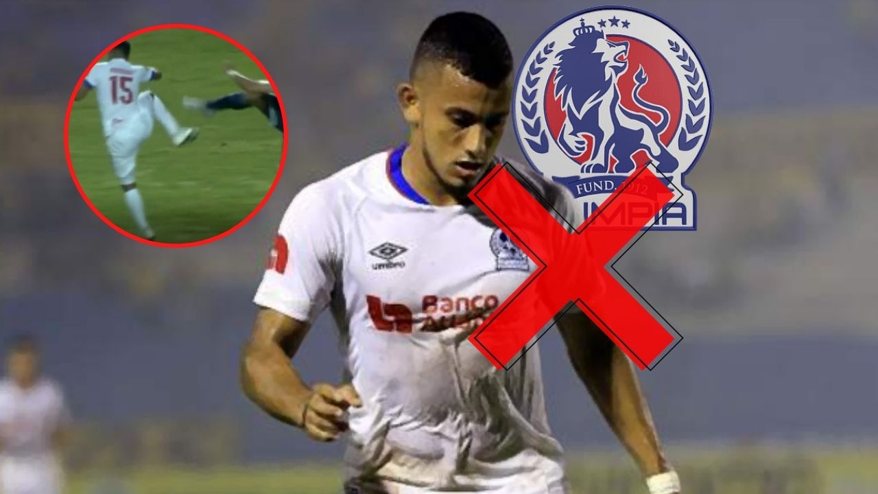 La razón por la que Edwin Rodríguez no fue habilitado para el partido contra Motagua
