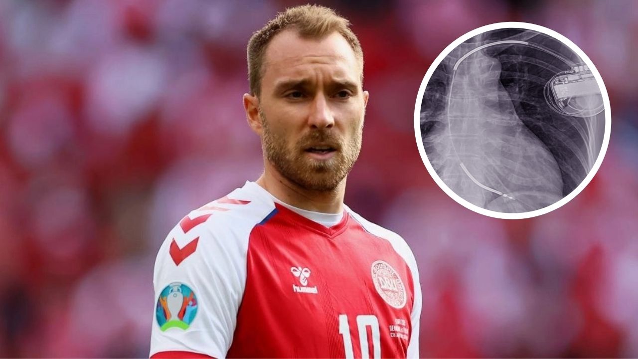 Christian Eriksen será operado para implantarle un desfibrilador automático