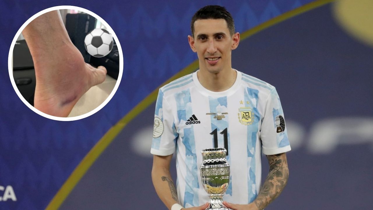 Esposa de Di María mostró cómo le quedó el pie al Fideo tras alzar la Copa América con Argentina
