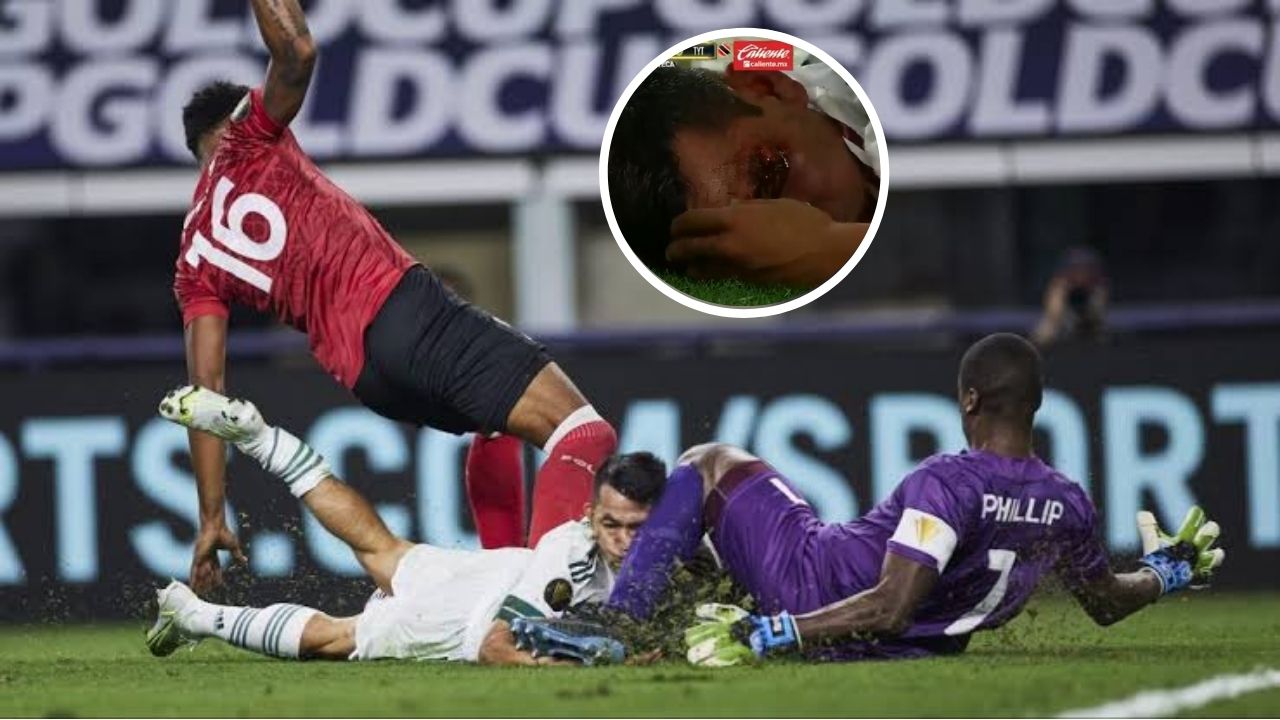 Usuarios en redes reaccionan tras la dura falta que recibó Chucky Lozano ante Trinidad