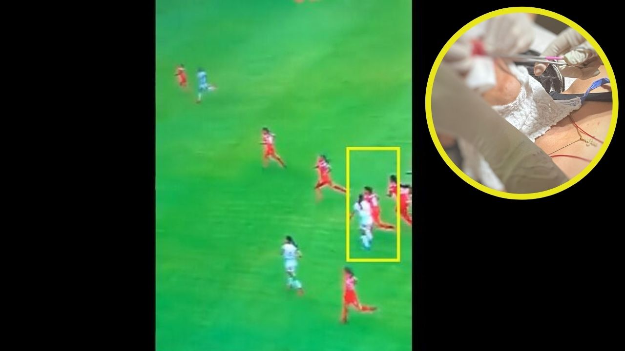 Salvaje agresión en el fútbol femenino en Colombia: jugadora acabó en el hospital