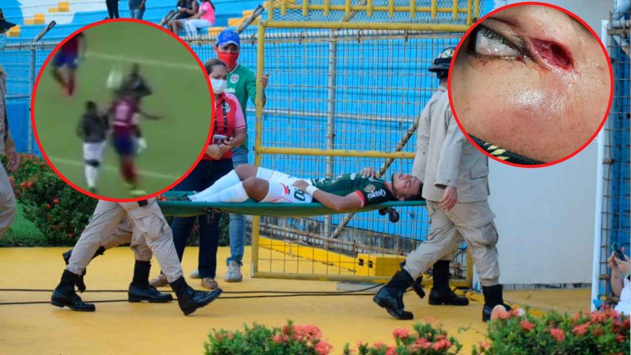 La terrible lesión que dejó herido y con sangre a Mario Martínez en el clásico