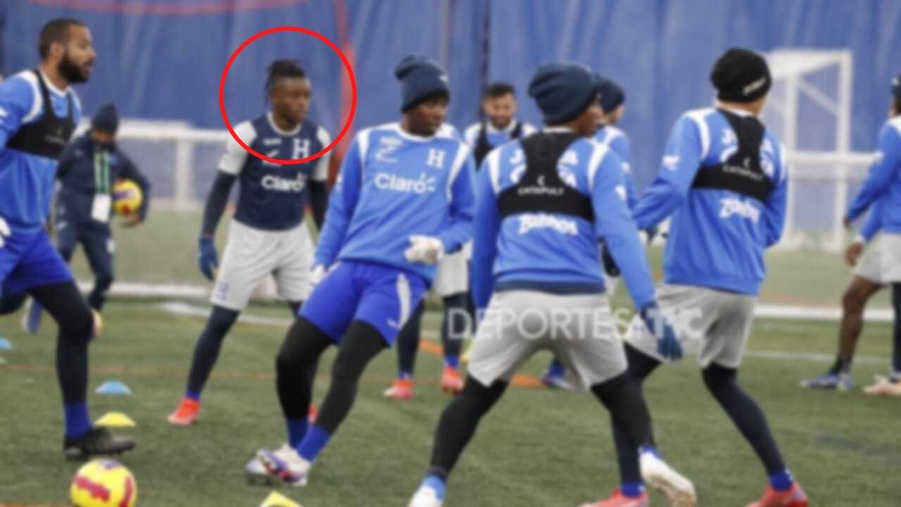 Jugador de Honduras se lesiona sin darse cuenta durante el duelo ante Estados Unidos