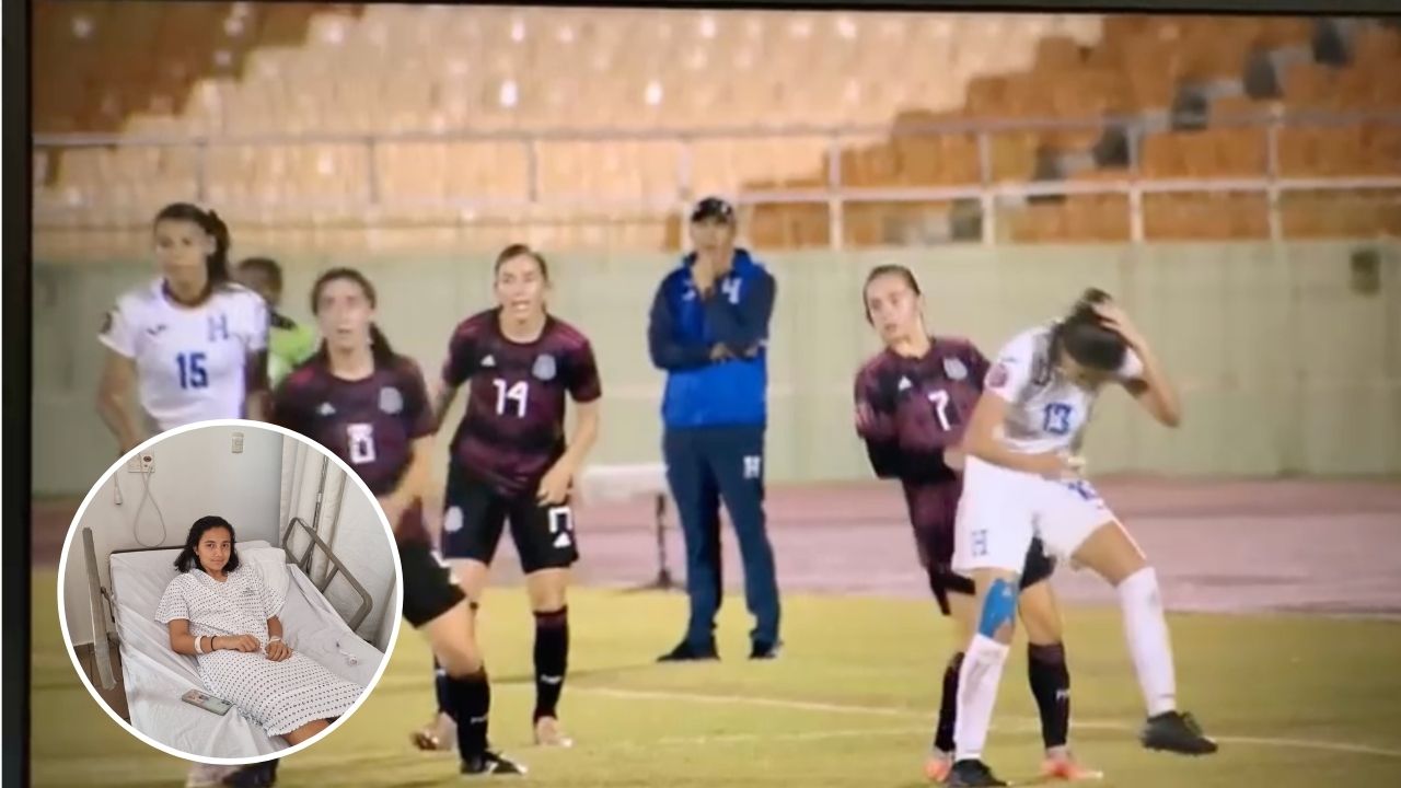 Seleccionada hondureña fue enviada al hospital tras golpe en la cabeza de jugadora mexicana