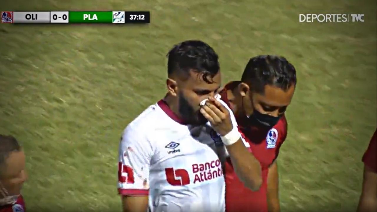 Jorge Álvarez conoce el tiempo de baja que estará luego de fuerte choque frente a Platense