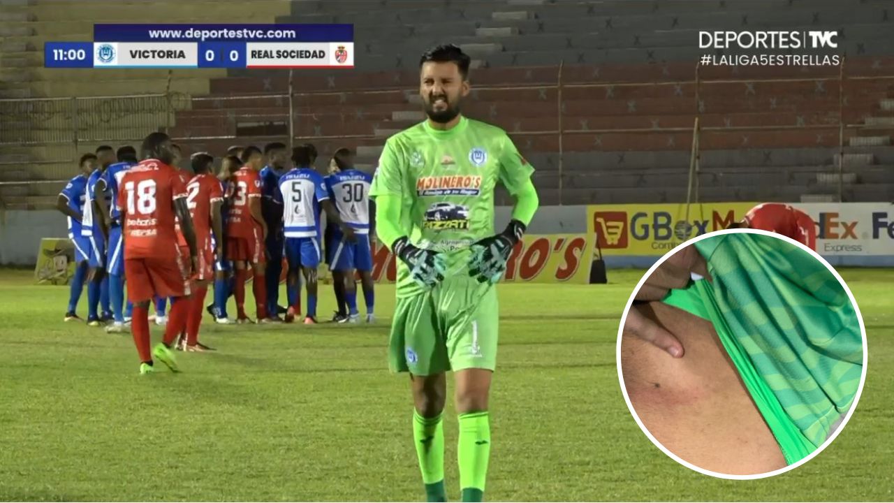 Portero del Victoria muestra la herida que le dejó Diego Reyes en jugada donde fue expulsado