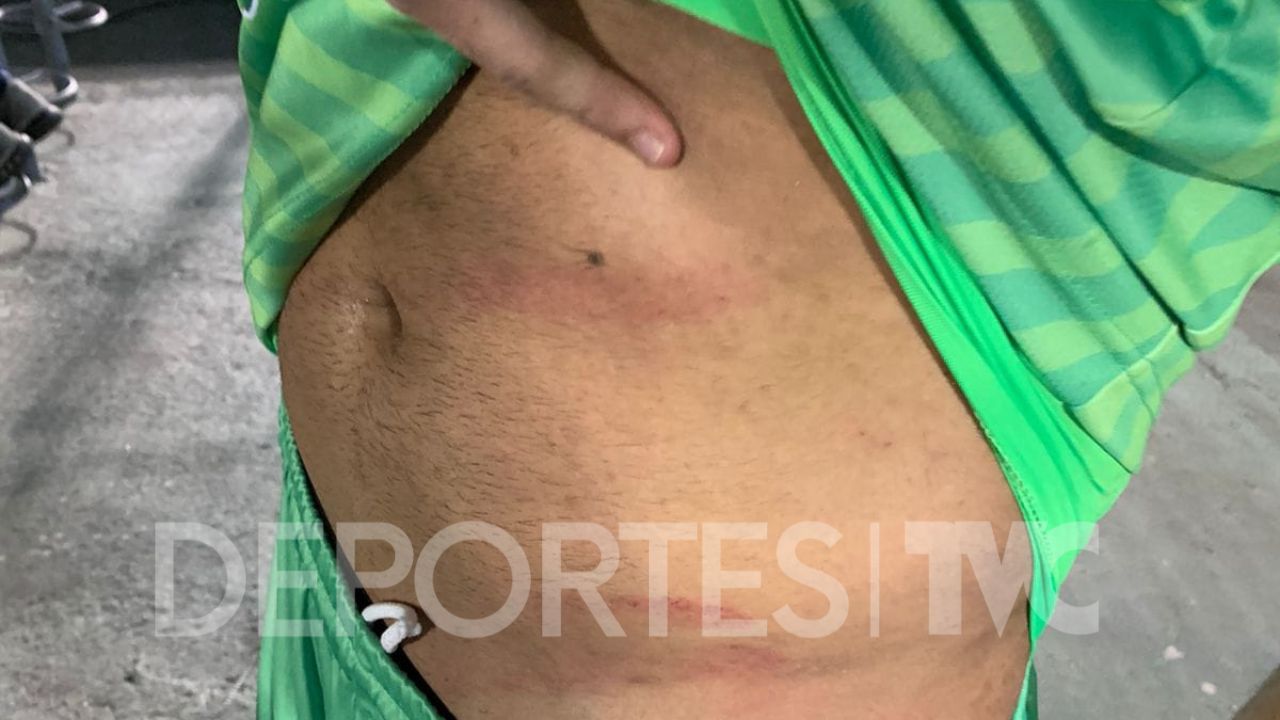 Portero del Victoria muestra la herida que le dejó Diego Reyes en jugada donde fue expulsado