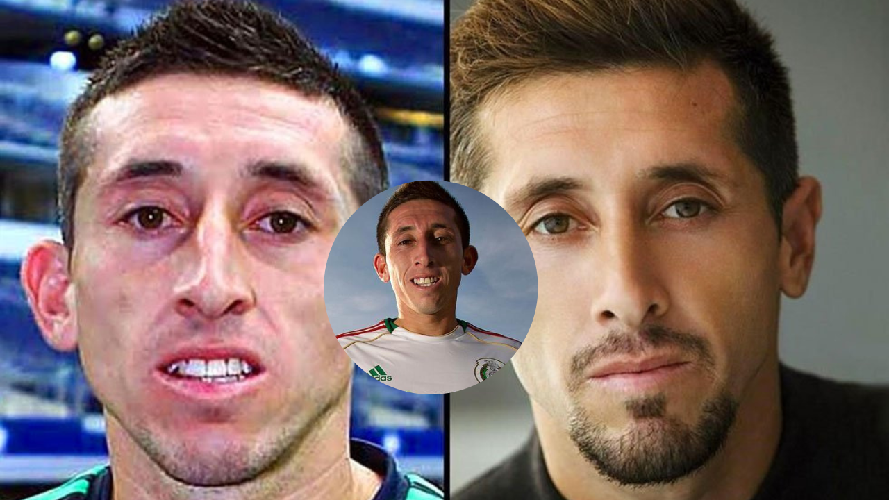 Héctor Herrera antes y después, cirugías y cambios estéticos