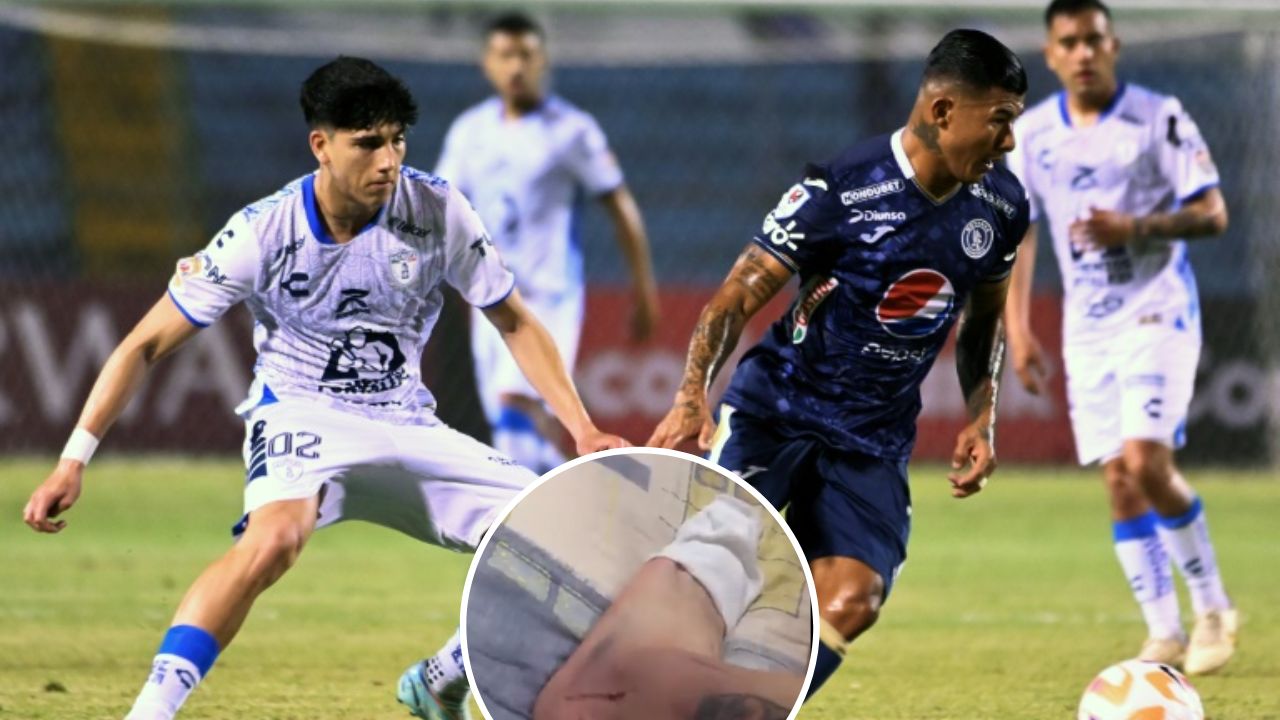 Jugador de Pachuca con increíble denuncia sobre el partido contra Motagua