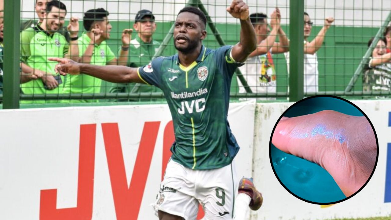 Clayvin Zúniga comparte su estado físico tras salir lesionado contra Olimpia