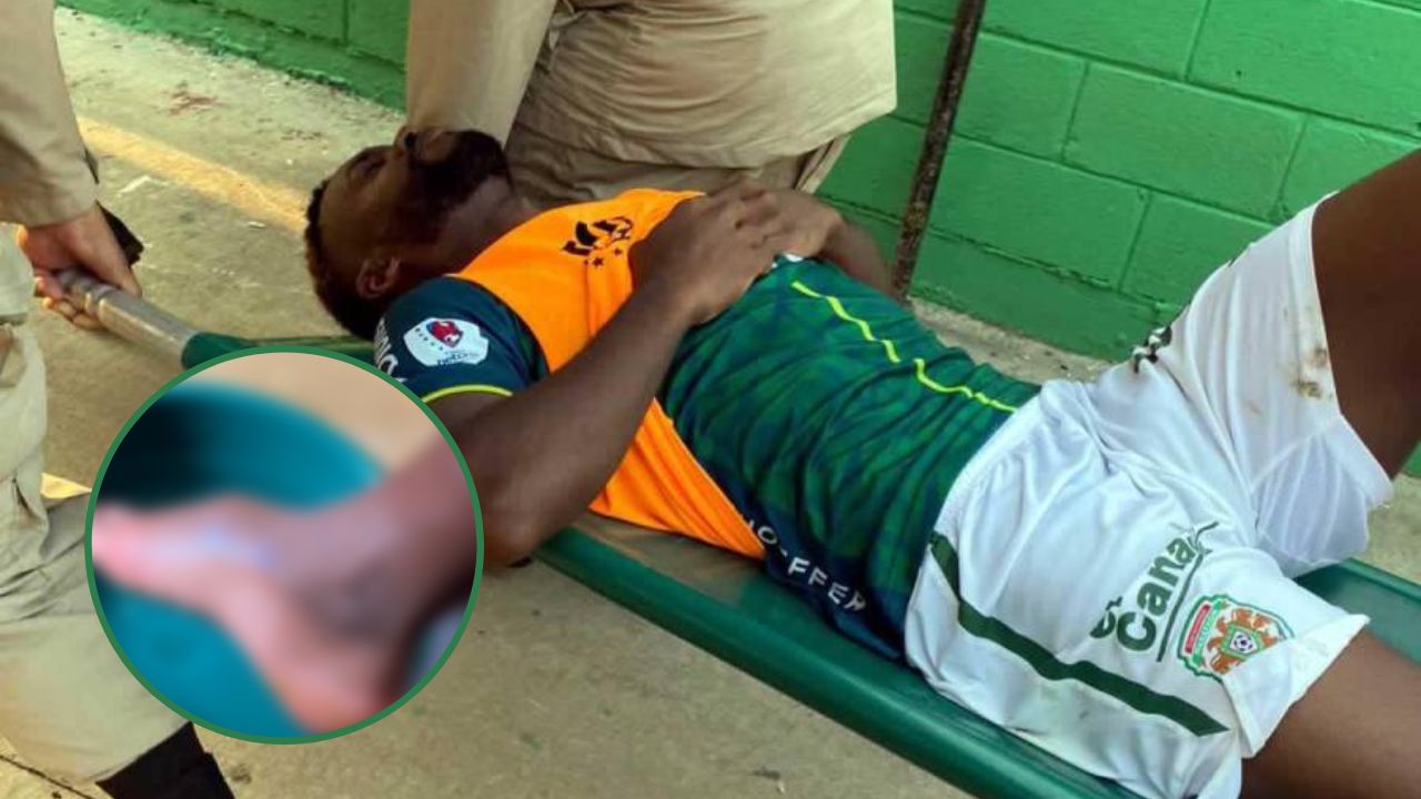 Clayvin Zúniga expone cómo quedó su pie tras lesionarse contra Olimpia