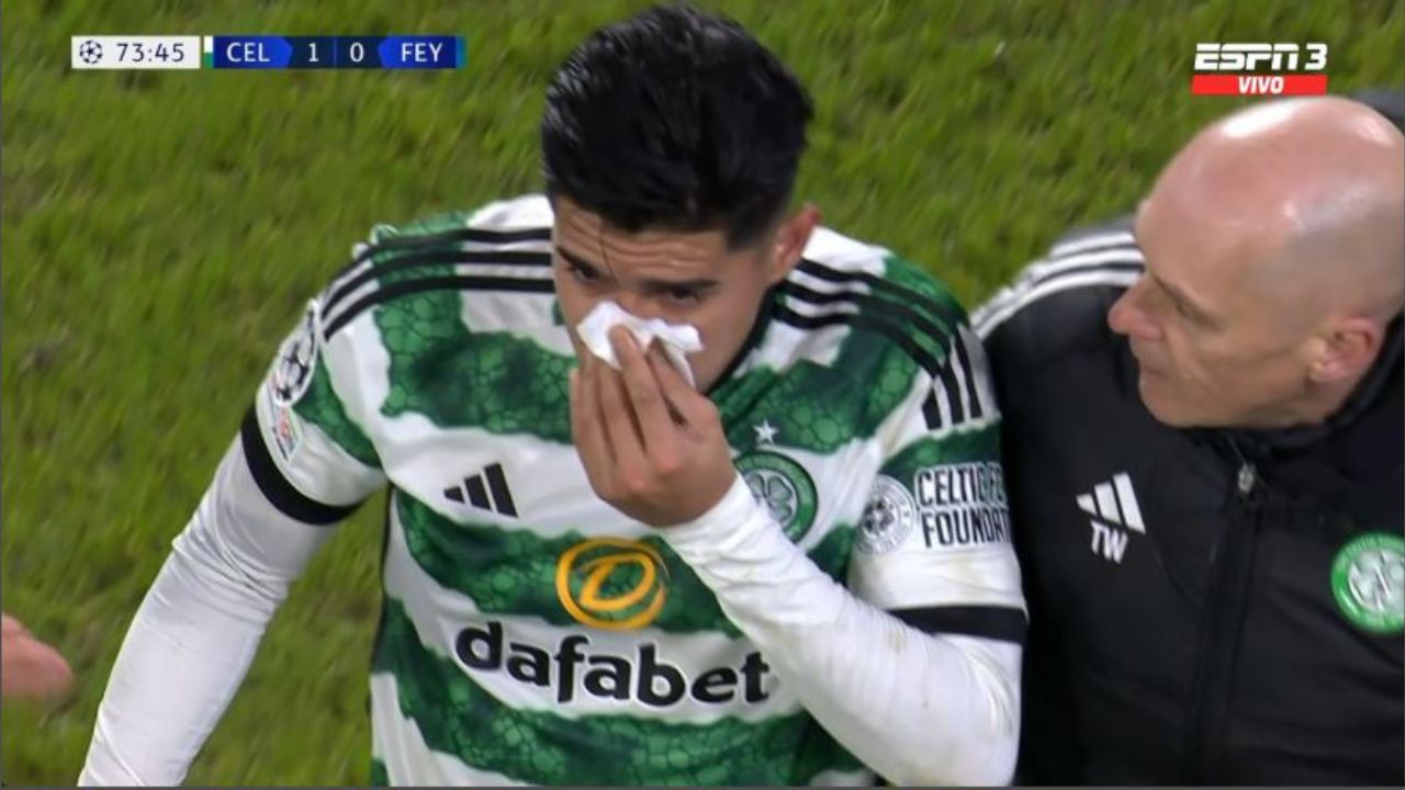 El fuerte codazo que recibió Luis Palma y lo terminó sacando del partido