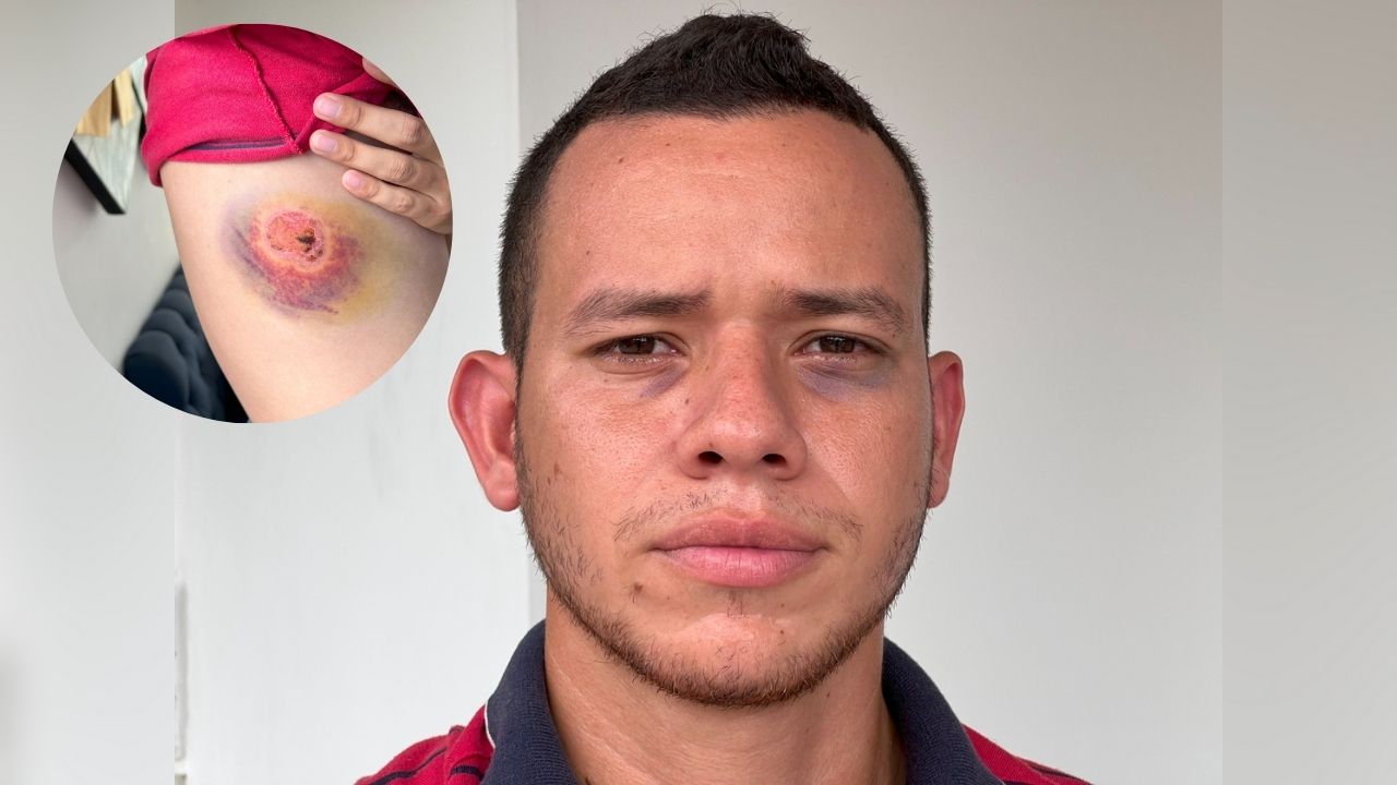 Árbitro que fue golpeado por más de 10 personas, ¿quién es, dónde vive y en qué liga pitaba?