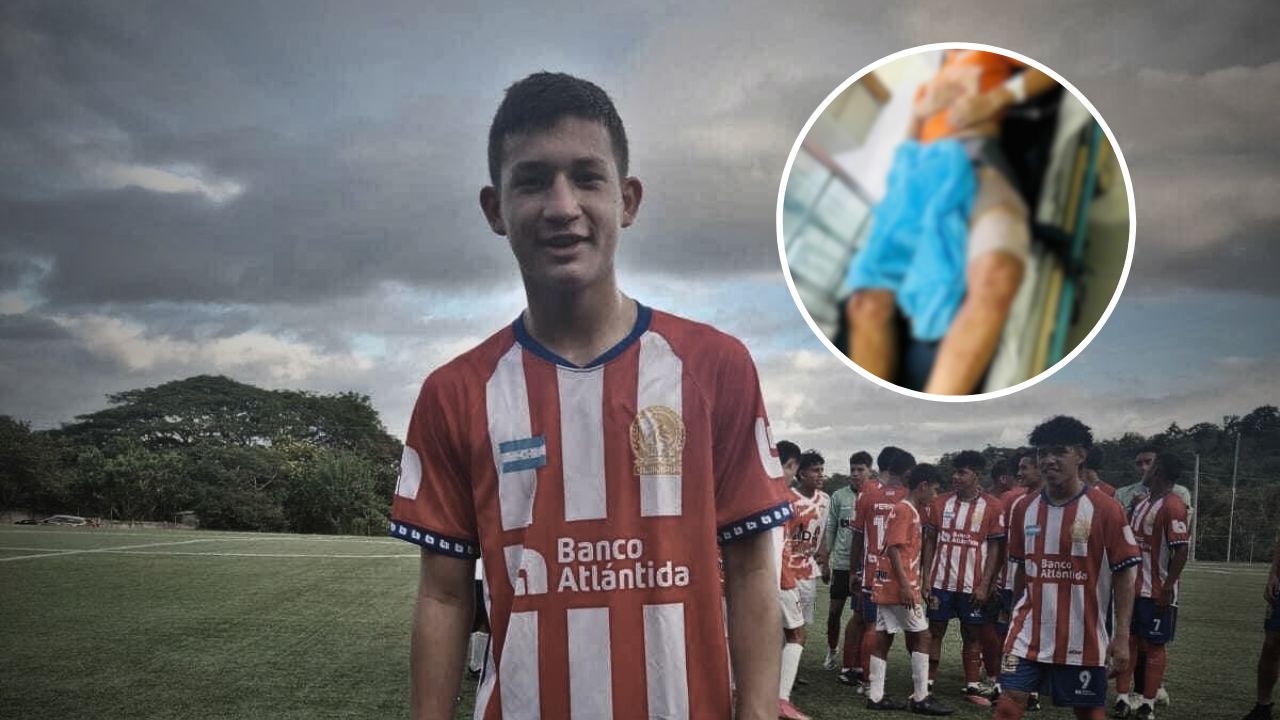 Joven jugador de Olimpia sufre terrible atentado y todo por robarle una motocicleta