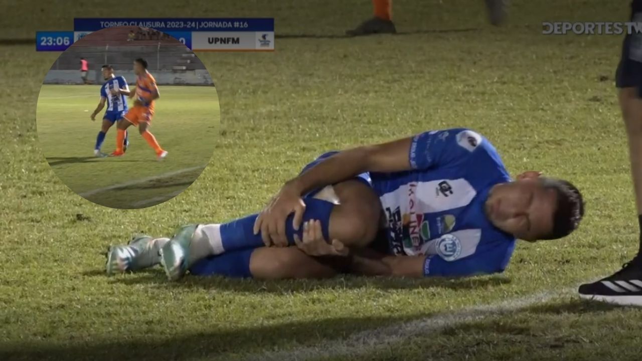 Así fue la escalofriante lesión de Diego Rodríguez en el Victoria vs UPNFM