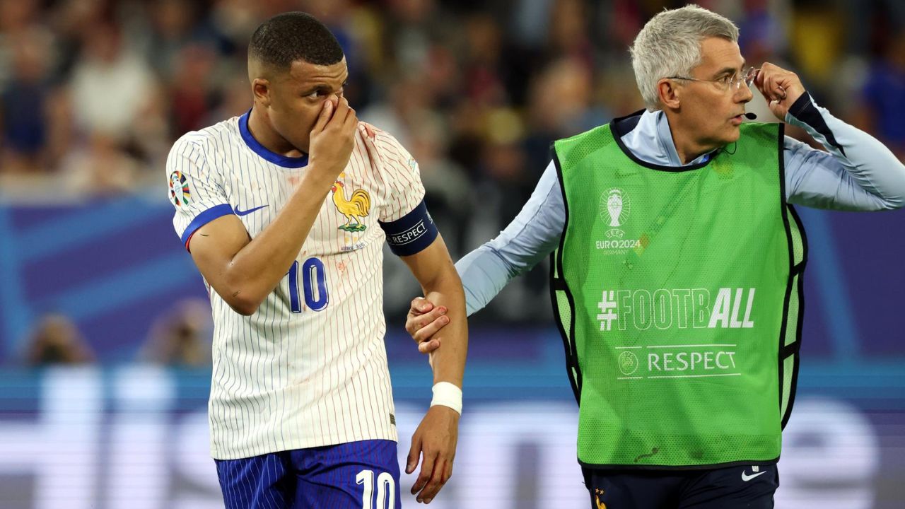 Kylian Mbappé no será operado de su nariz pero usará una máscara en su cara