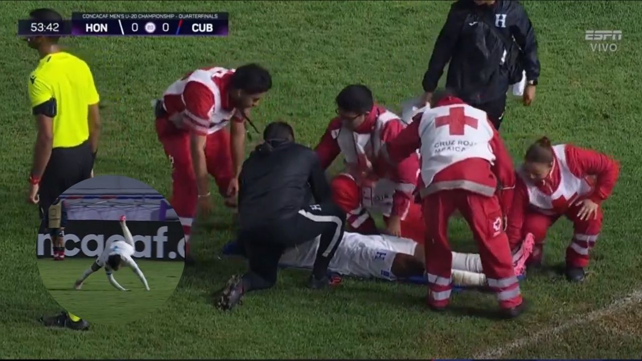 Jugador de la Selección Sub-20 sufre grave lesión y sale en camilla del partido vs Cuba