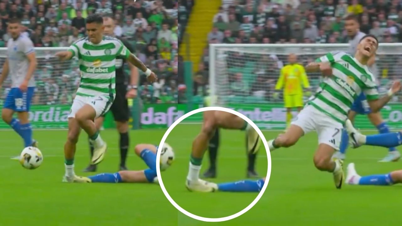 Luis Palma recibió dura entrada frente a Kilmarnock que pudo causarle grave lesión