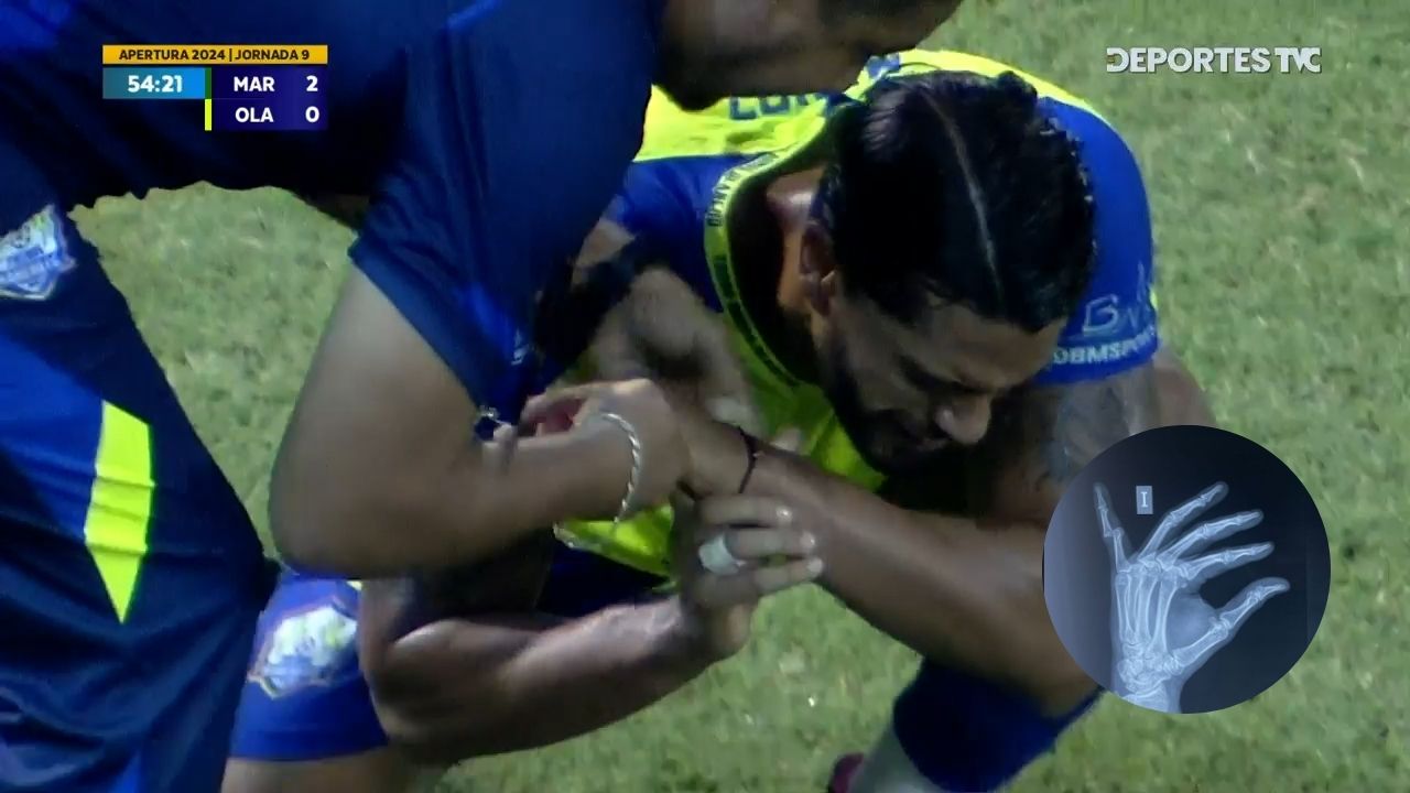 Nelson Muñoz se dislocó un dedo en partido Marathón vs Olancho FC