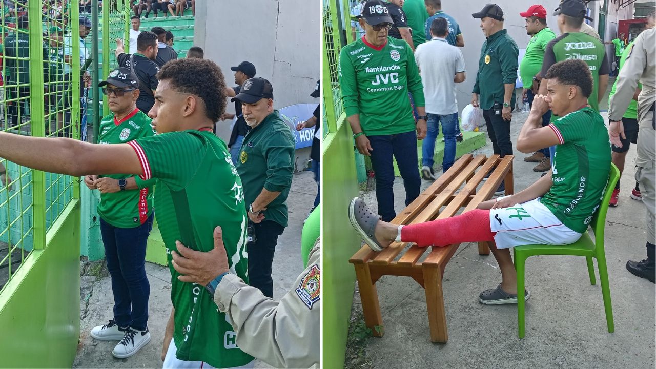 Javier Arriaga fue enyesado tras golpe en su rodilla en partido Marathón vs Génesis