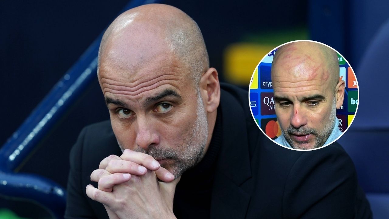 Pep Guardiola sorprende con heridas en su rostro ¿Qué le pasó al técnico español?