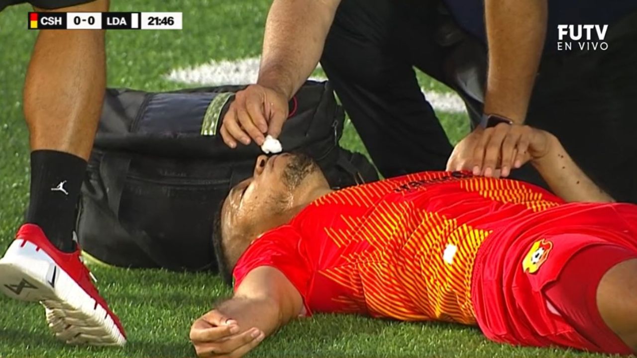 Getsel Montes sufre golpe en la cabeza en final de Costa Rica
