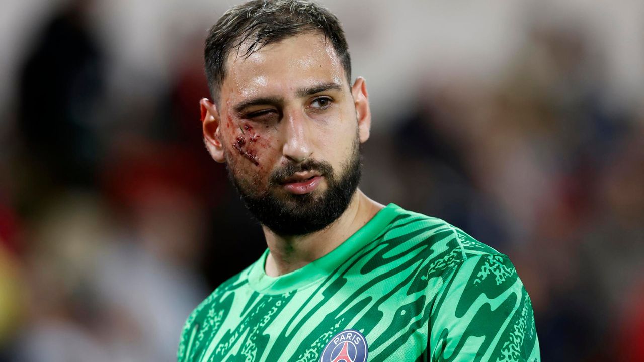Gianluigi Donnarumma sufre terrible lesión que le provocó heridas en su rostro