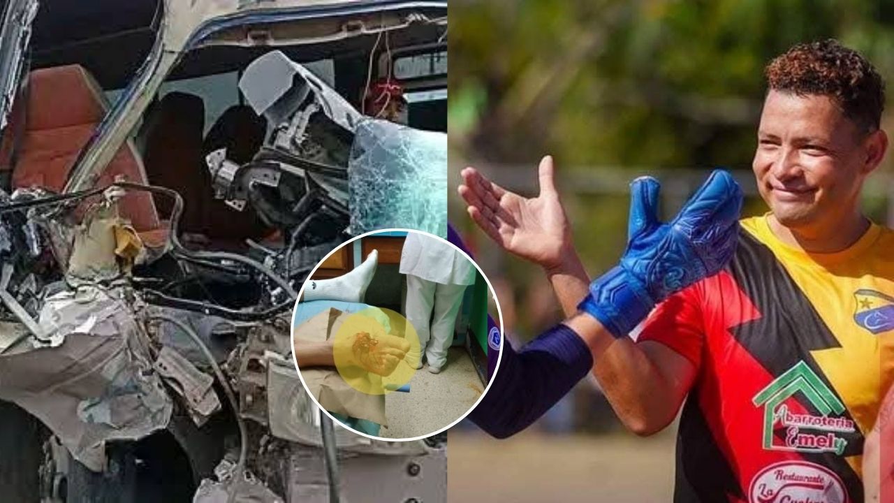 Futbolista hondureño sufre terrible fractura tras accidente en el bus de su club