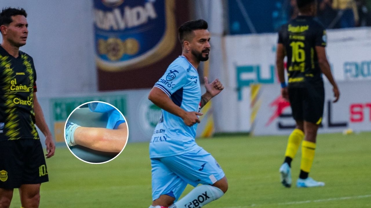 La verdad sobre la lesión de Droopy Gómez tras la semifinal ante Real España