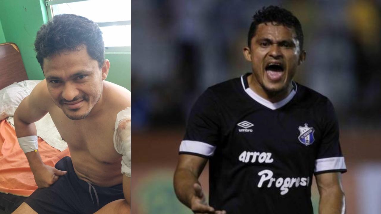 Lo último sobre el estado de Ñangui Cardona, exfutbolista que fue agredido con un machete