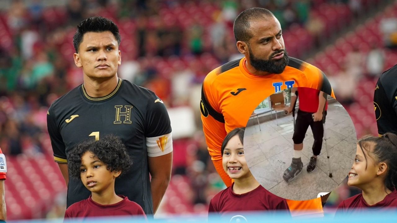Denil Maldonado es operado con éxito de su tobillo y es baja para la Selección de Honduras