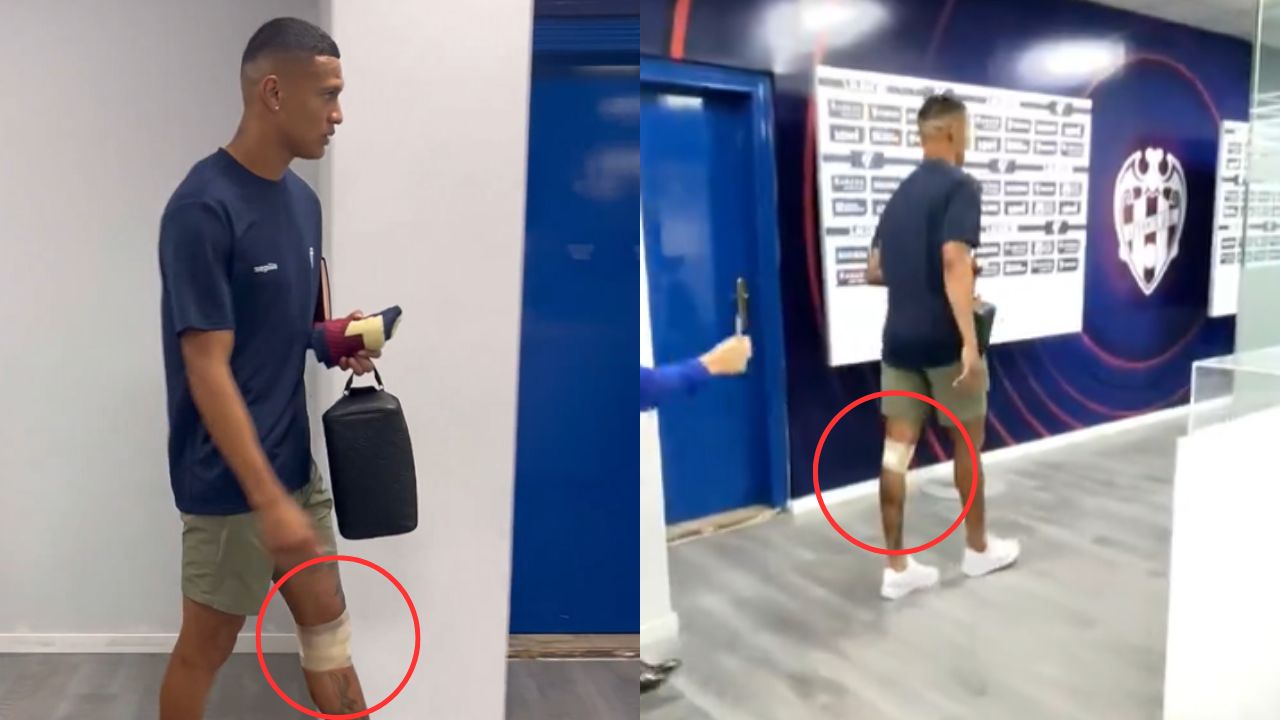 Kervin Arriaga es captado renqueando tras partido contra Real Madrid