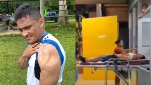 Ñangui Cardona rompe el silencio sobre el viral atentado que sufrió con un machete