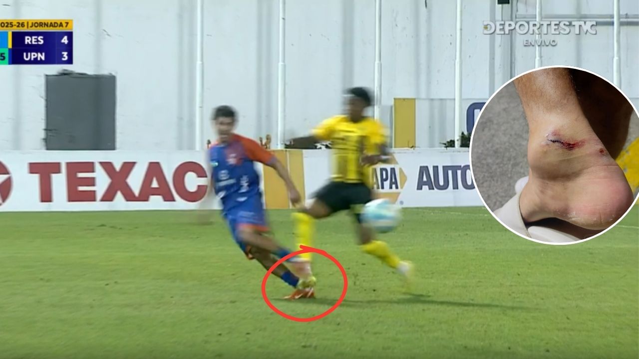 Lobos UPN denuncia agresión contra Marcos Morales y pide castigo para jugador de Real España