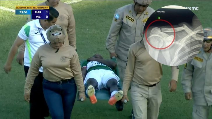 Jugador del Marathón se pierde resto del torneo tras fracturarse la clavícula