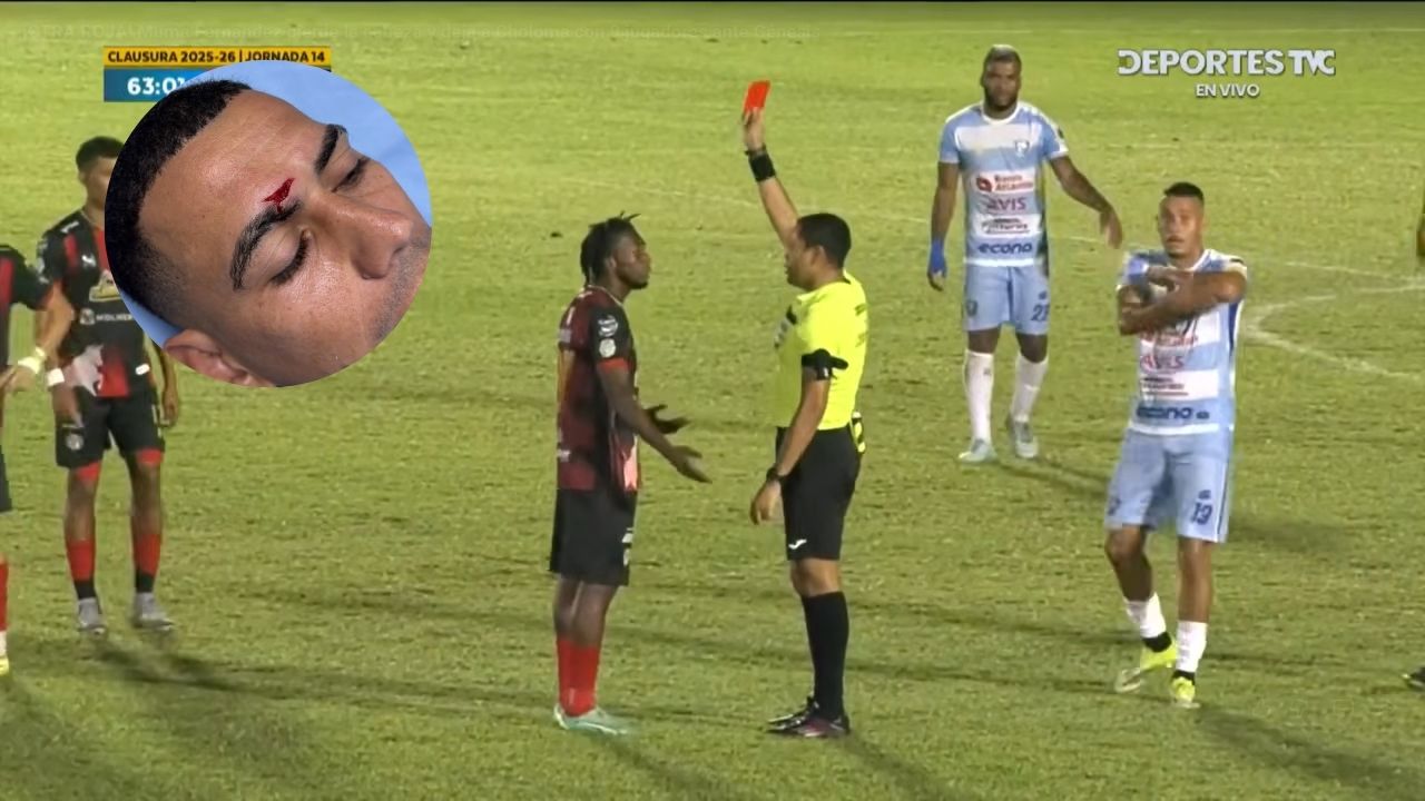 Carlos Fernández responde a acusaciones por expulsión ante Génesis