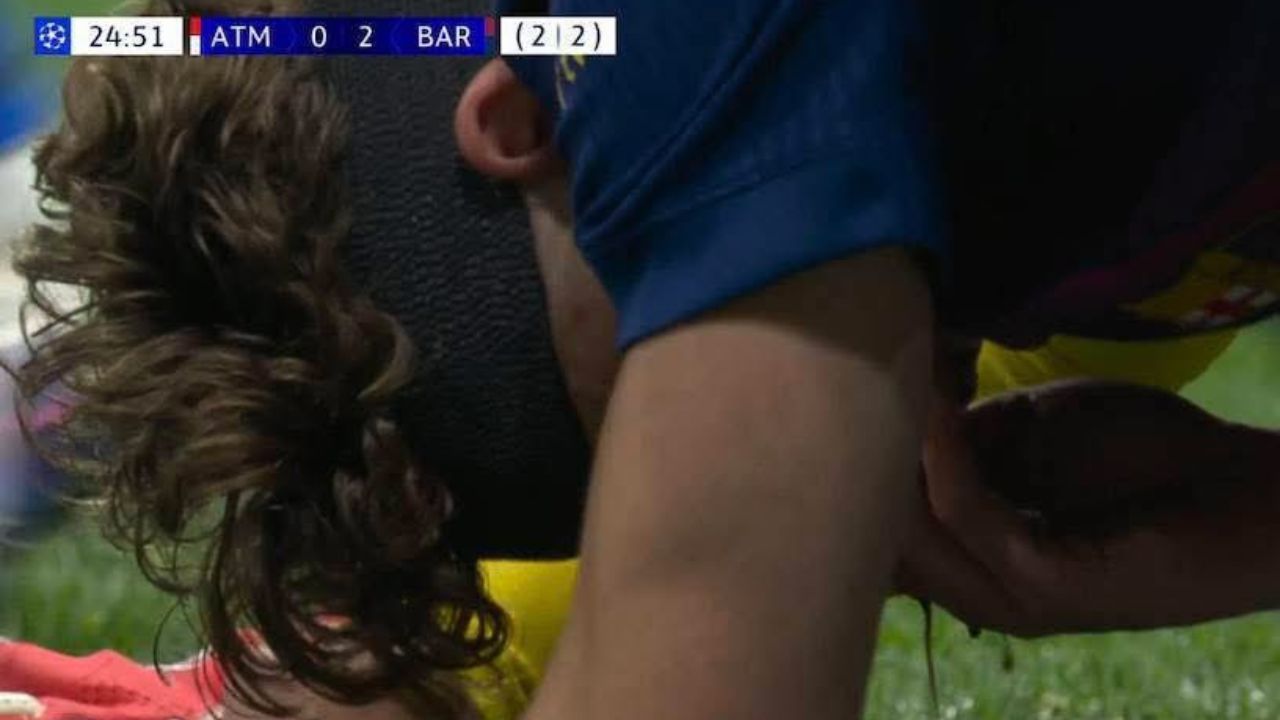 Fermin derramó chorros de sangres tras encontronazo contra Juan Musso