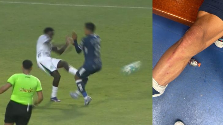 Motagua expone como quedó Denis Meléndez tras fuerte entrada de rival