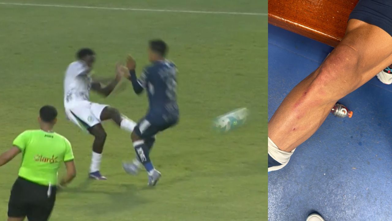 Motagua expone como quedó Denis Meléndez tras fuerte entrada de rival