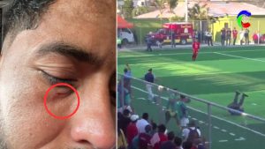 Exjugador de Olimpia sufre pedrada de afición rival tras partido en el Ascenso