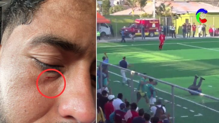 Exjugador de Olimpia sufre pedrada de afición rival tras partido en el Ascenso