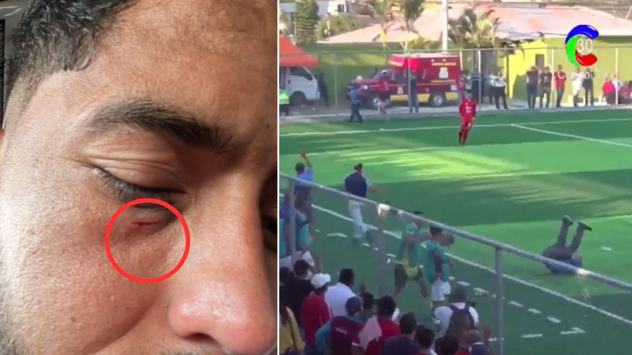 Exjugador de Olimpia sufre pedrada de afición rival tras partido en el Ascenso
