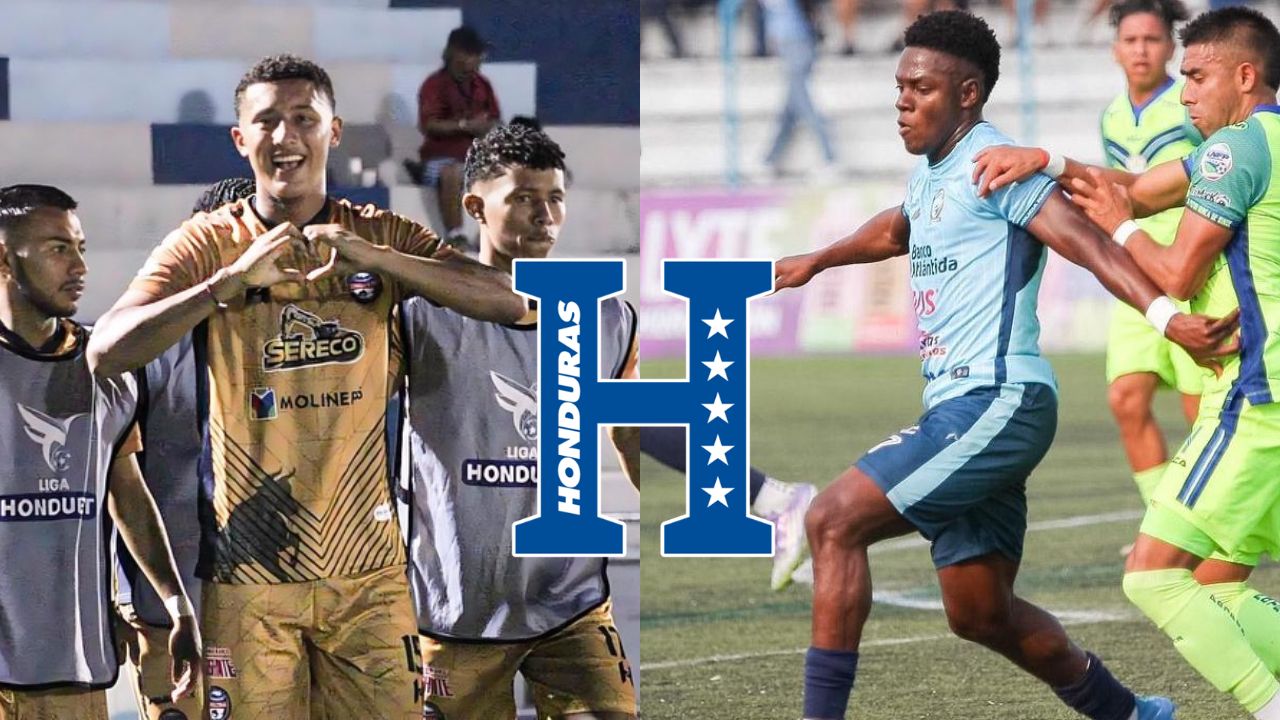Convocatoria Honduras vs Argentina; novedades y ausencias notables de José Molina