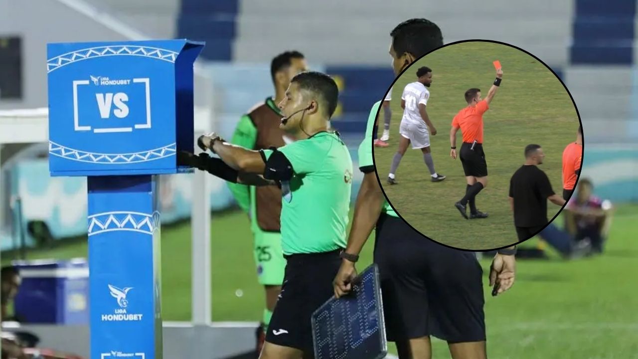Liga de Francia implementa el FVS imitando la iniciativa de Honduras