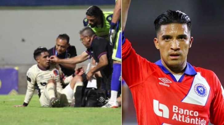 Michaell Chirinos confirma el tiempo que estará de baja tras fractura en su cara