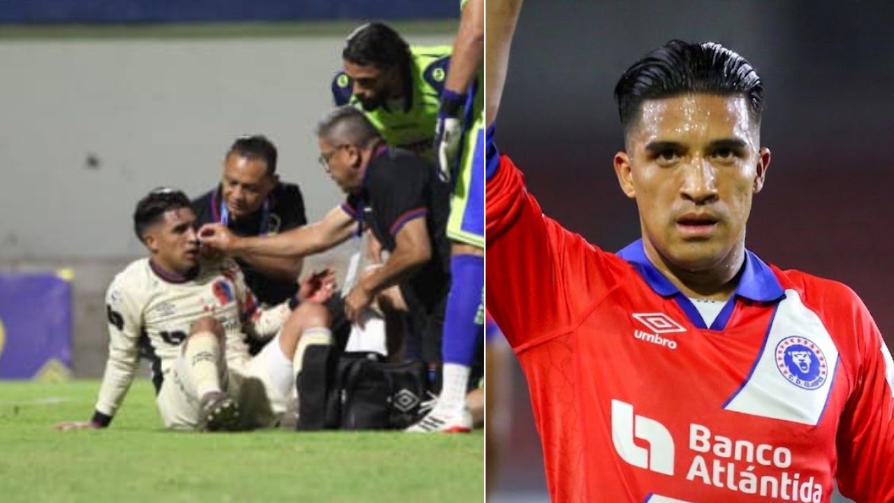 Michaell Chirinos confirma el tiempo que estará de baja tras fractura en su cara