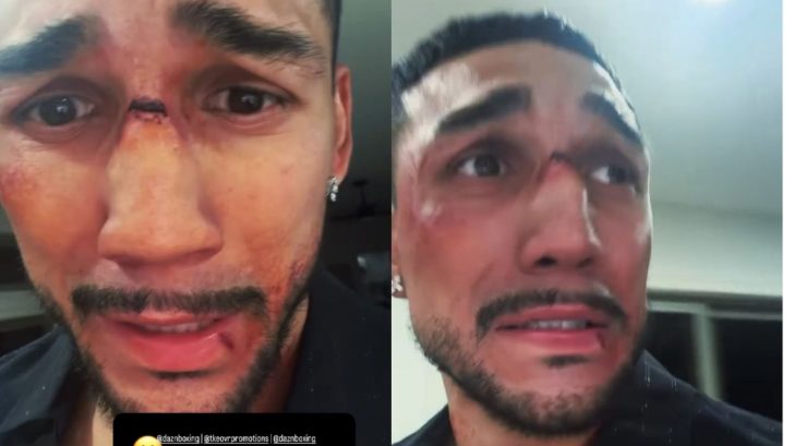 Teófimo López aparece golpeado y sangrando previo a su pelea con Rolly Romero