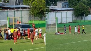 Así le quedó el rostro a jugador de reservas que sufrió accidente en partido